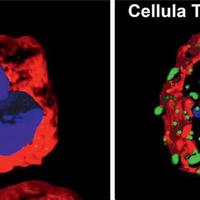 Immagini di una cellula (linfocita) T non modificata geneticamente, a destra la cellula modificata attraverso un recettore chimerico antigenico (Car)