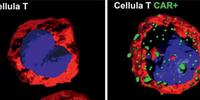 Immagini di una cellula (linfocita) T non modificata geneticamente, a destra la cellula modificata attraverso un recettore chimerico antigenico (Car)