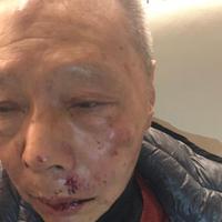 Ye Liang Dhi con il volto tumefatto dopo l'aggressione di lunedì pomeriggio