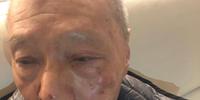 Ye Liang Dhi con il volto tumefatto dopo l'aggressione di lunedì pomeriggio