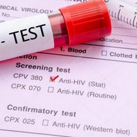 Nuovi casi di Aids emersi da uno screening sull'Hiv in Abruzzo