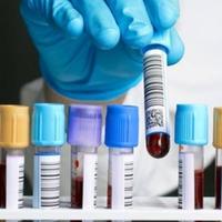 Un laboratorio di ematologia. In Abruzzo si registrano 49,5 casi di malattie del sangue ogni diecimila abitanti