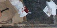 Fazzoletti sporchi di sangue raccolti a Villa Rosa
