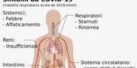 I sintomi del Coronavirus (da Wilkipedia)